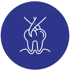 Tooth Extraction